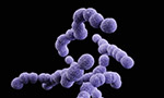 Imagen escaneada de un grupo de bacterias púrpuras sobre fondo negro.